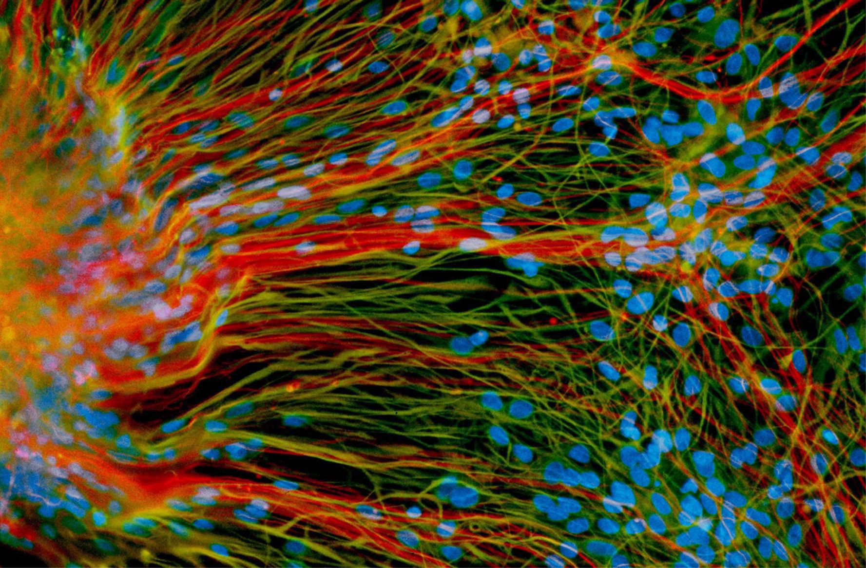 Glial Cell